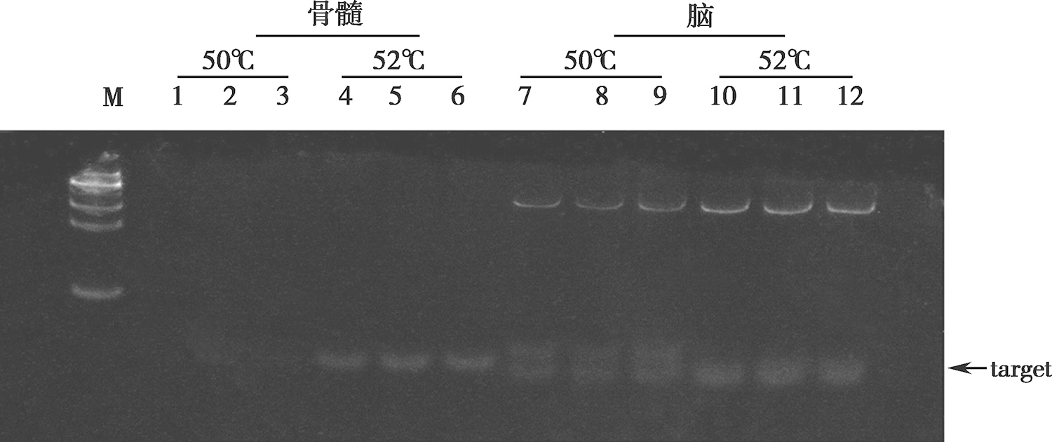 图5 脑及骨髓的组织DNA PCR产物大小一致